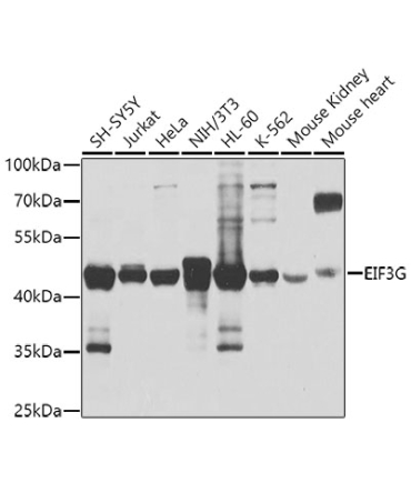 EIF3G Rabbit Polyclonal Antibody