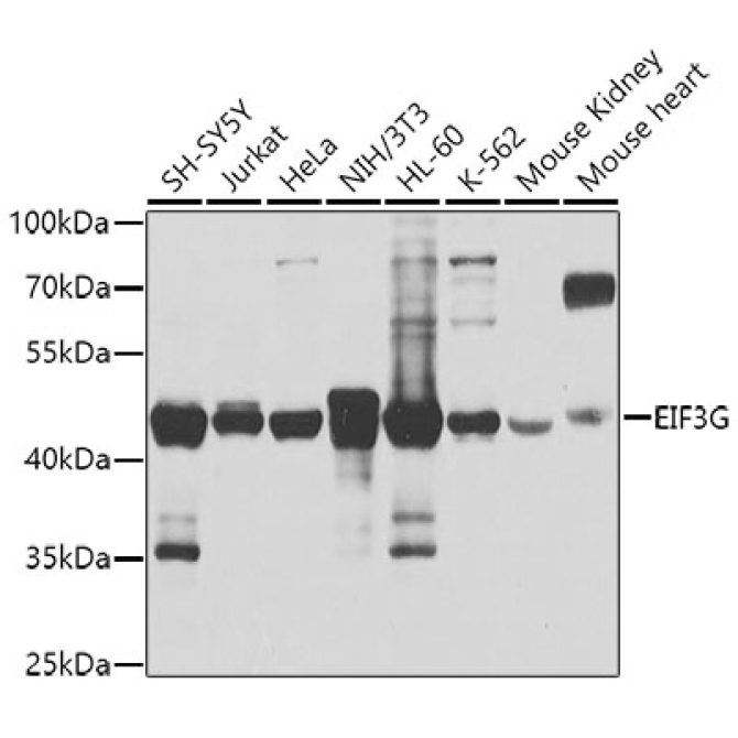 EIF3G Rabbit Polyclonal Antibody