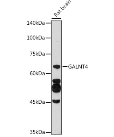 GALNT4 Rabbit Polyclonal Antibody
