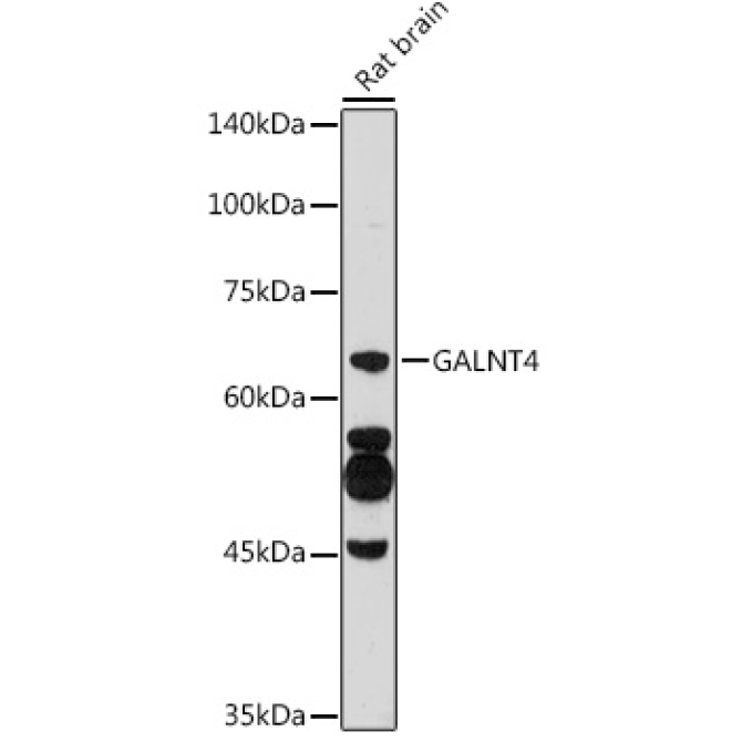 GALNT4 Rabbit Polyclonal Antibody