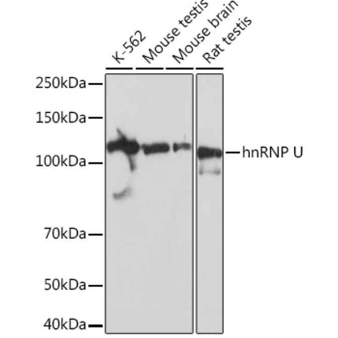 hnRNP U Rabbit Monoclonal Antibody