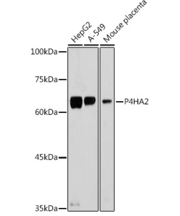P4HA2 Rabbit Polyclonal Antibody