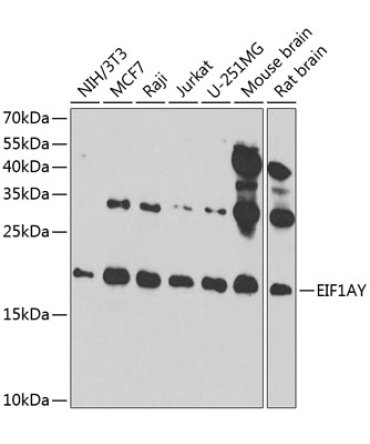 EIF1AY Rabbit Polyclonal Antibody
