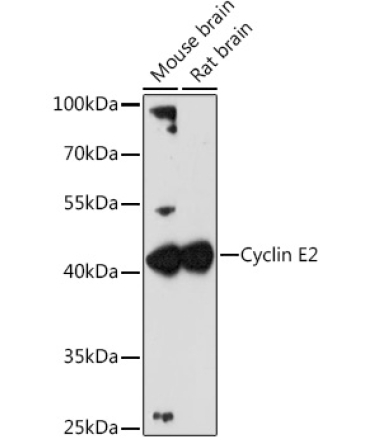 Cyclin E2 Rabbit Polyclonal Antibody