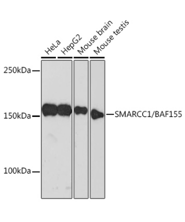 SMARCC1/BAF155 Rabbit Monoclonal Antibody [KO Validated]
