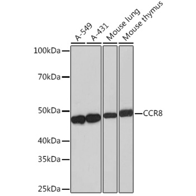 CCR8 Rabbit Monoclonal Antibody