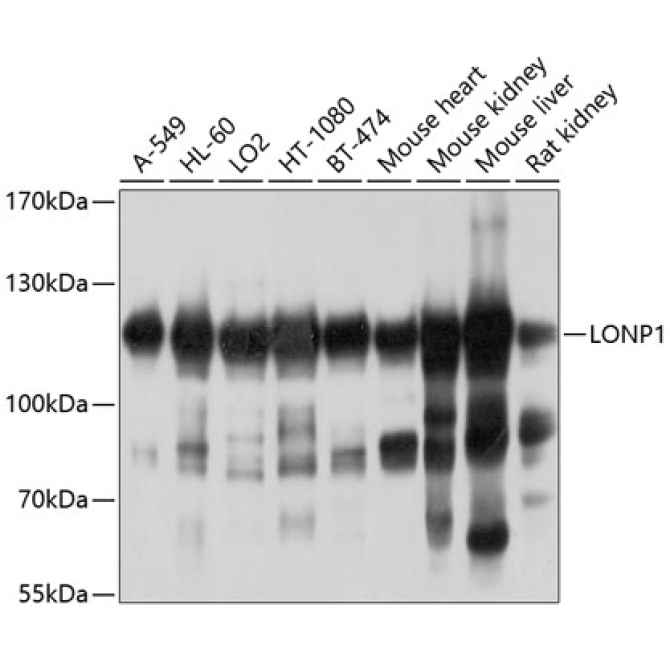 LONP1 Rabbit Polyclonal Antibody