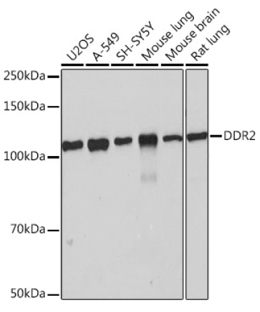 DDR2 Rabbit Monoclonal Antibody
