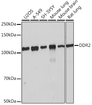 DDR2 Rabbit Monoclonal Antibody