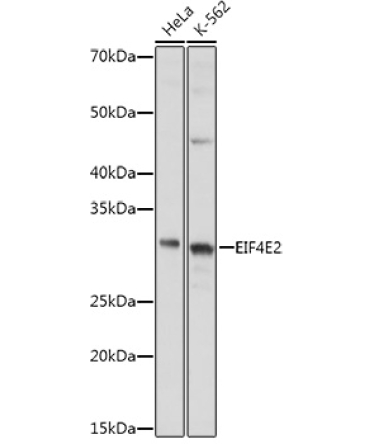 EIF4E2 Rabbit Polyclonal Antibody