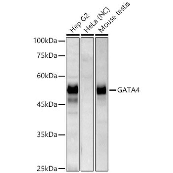 GATA4 Rabbit Monoclonal Antibody