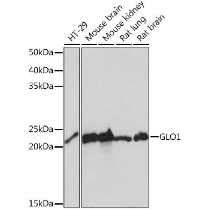 GLO1 Rabbit Monoclonal Antibody
