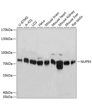 NUP93 Rabbit Polyclonal Antibody