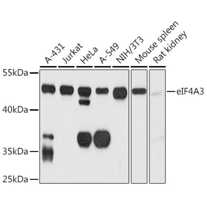 eIF4A3 Rabbit Polyclonal Antibody