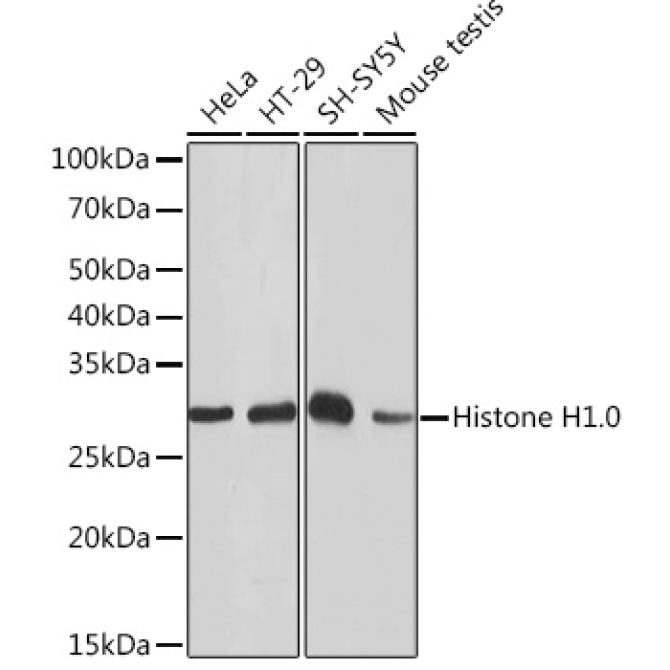 Histone H1.0 Rabbit Monoclonal Antibody