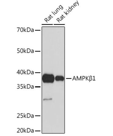 AMPKBeta1 Rabbit Monoclonal Antibody