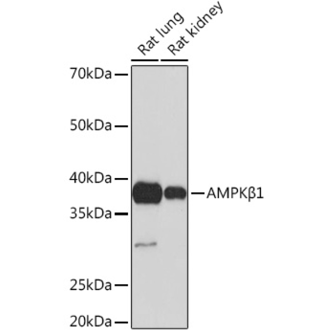 AMPKBeta1 Rabbit Monoclonal Antibody