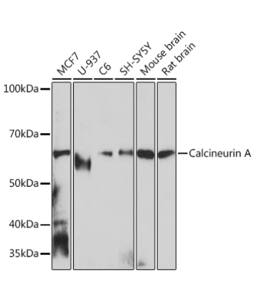 Calcineurin A Rabbit Monoclonal Antibody