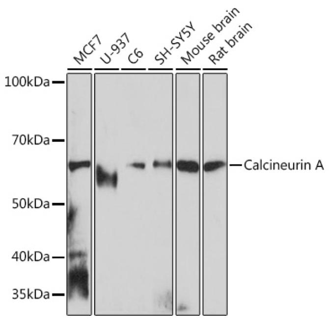 Calcineurin A Rabbit Monoclonal Antibody