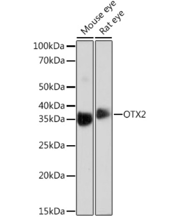 OTX2 Rabbit Monoclonal Antibody