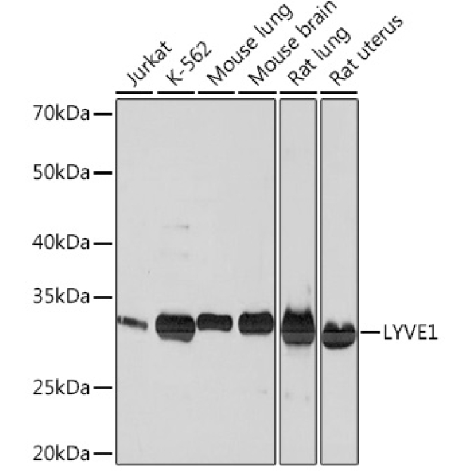 LYVE1 Rabbit Monoclonal Antibody