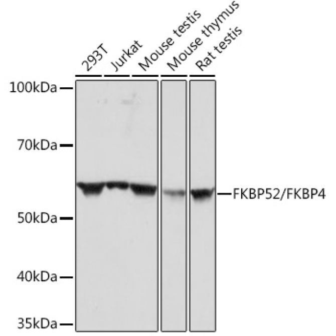 FKBP52/FKBP4 Rabbit Monoclonal Antibody