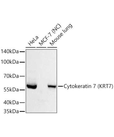 Cytokeratin 7 (CK7) Rabbit Monoclonal Antibody