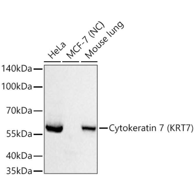 Cytokeratin 7 (CK7) Rabbit Monoclonal Antibody