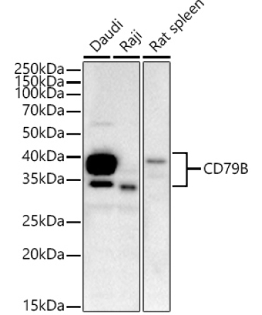 CD79B Rabbit Monoclonal Antibody