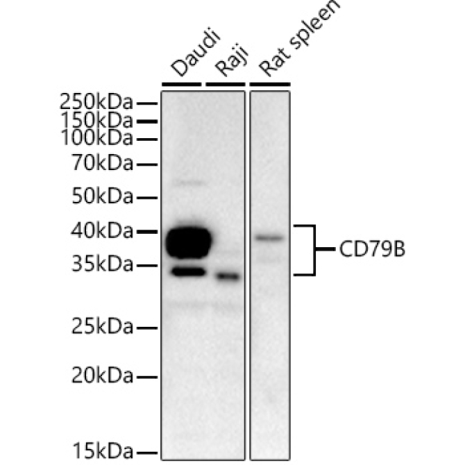 CD79B Rabbit Monoclonal Antibody