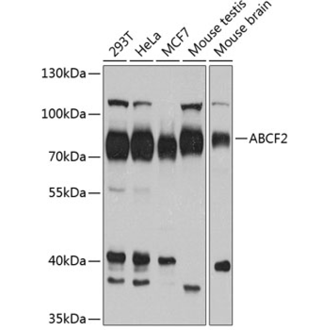 ABCF2 Rabbit Polyclonal Antibody