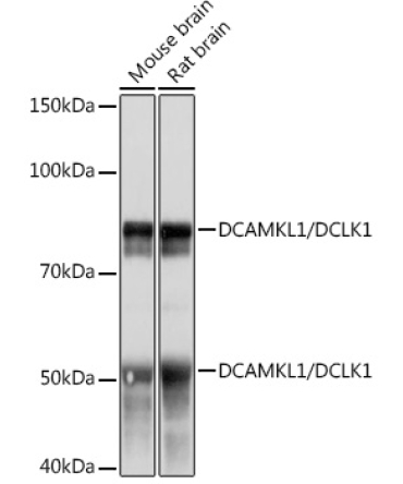 DCAMKL1/DCLK1 Rabbit Monoclonal Antibody