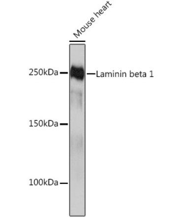 Laminin beta 1 Rabbit Monoclonal Antibody