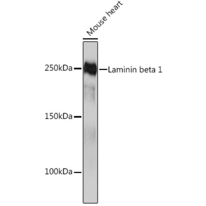 Laminin beta 1 Rabbit Monoclonal Antibody