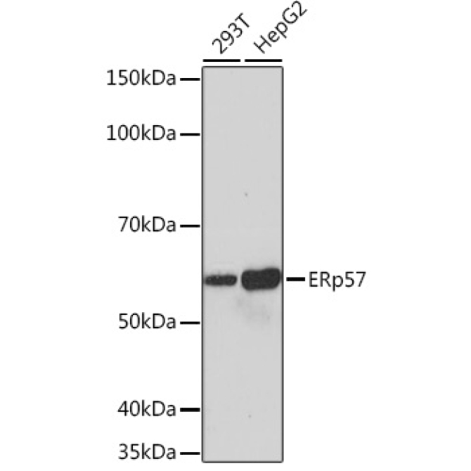 ERp57 Rabbit Monoclonal Antibody