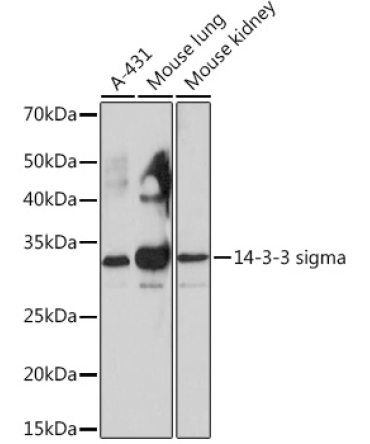 14-3-3 sigma Rabbit Monoclonal Antibody