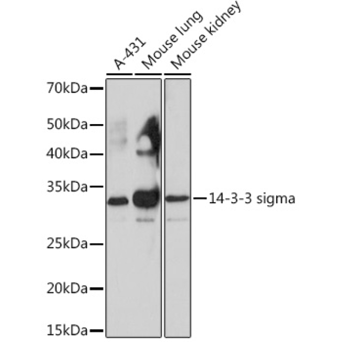 14-3-3 sigma Rabbit Monoclonal Antibody