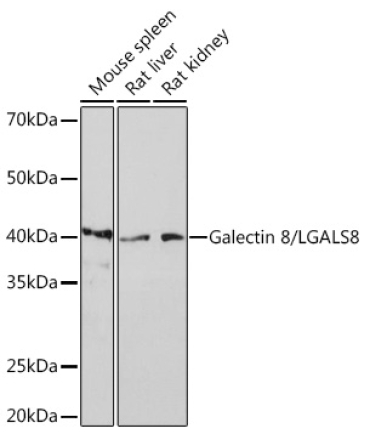 Galectin 8/LGALS8 Rabbit Monoclonal Antibody