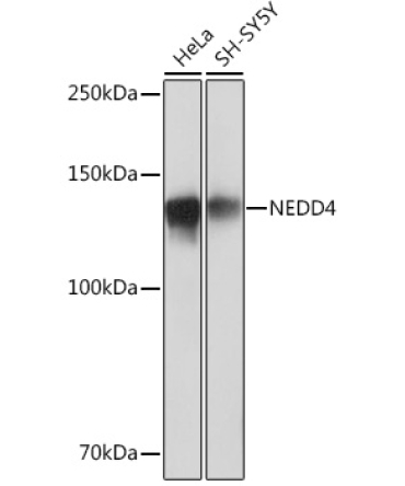NEDD4 Rabbit Monoclonal Antibody