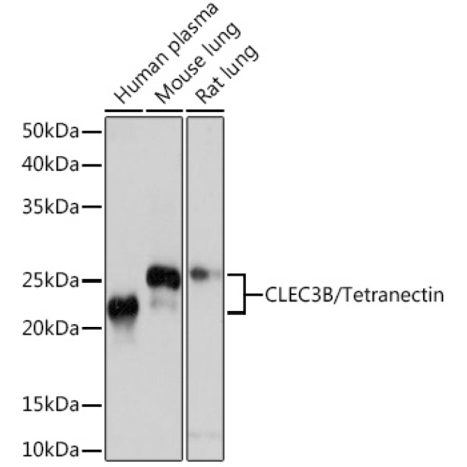 CLEC3B/Tetranectin Rabbit Monoclonal Antibody