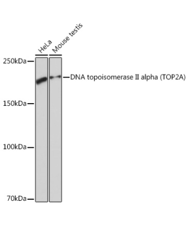 DNA topoisomerase II alpha (TOP2A) Rabbit Monoclonal Antibody