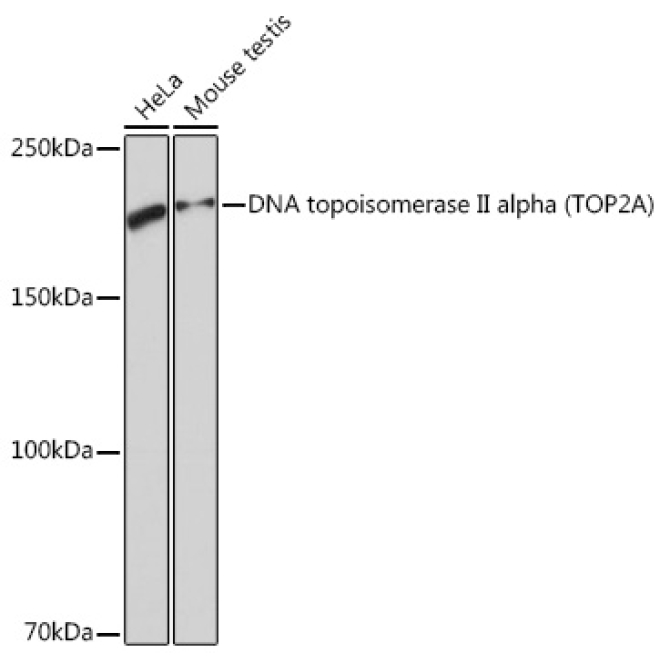DNA topoisomerase II alpha (TOP2A) Rabbit Monoclonal Antibody