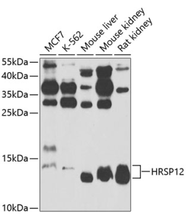 HRSP12 Rabbit Polyclonal Antibody