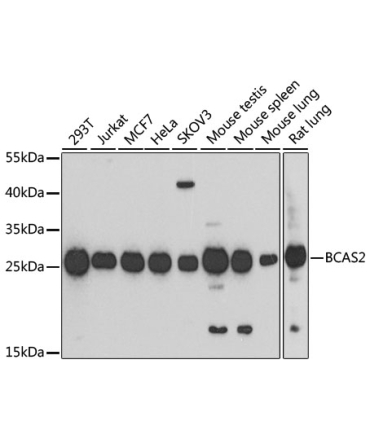 BCAS2 Rabbit Polyclonal Antibody