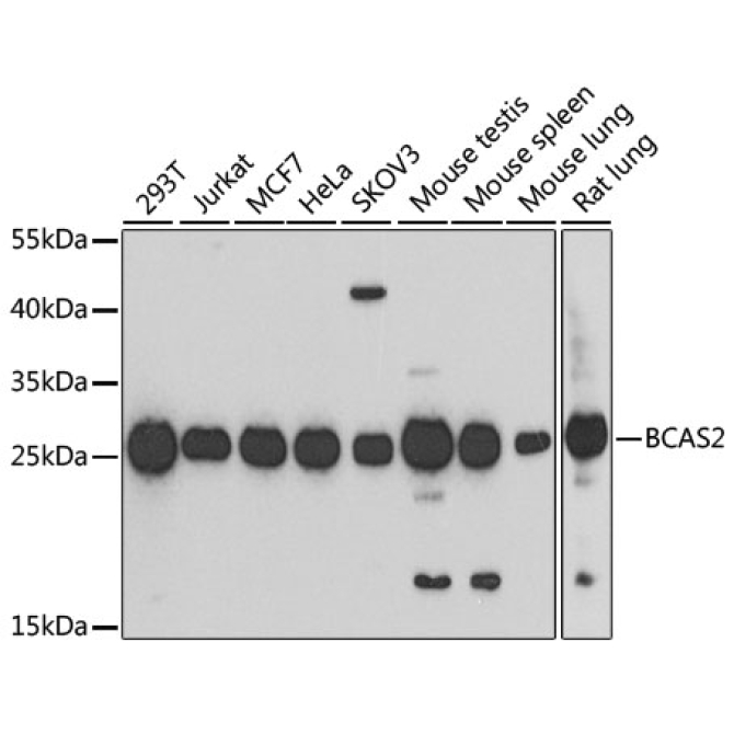 BCAS2 Rabbit Polyclonal Antibody