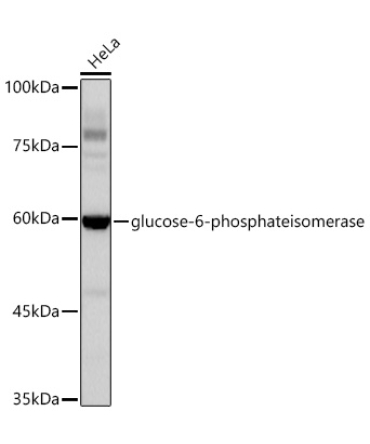 glucose-6-phosphate isomerase Rabbit Monoclonal Antibody [KD Validated]