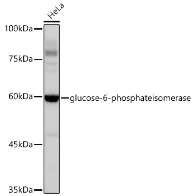 glucose-6-phosphate isomerase Rabbit Monoclonal Antibody [KD Validated]