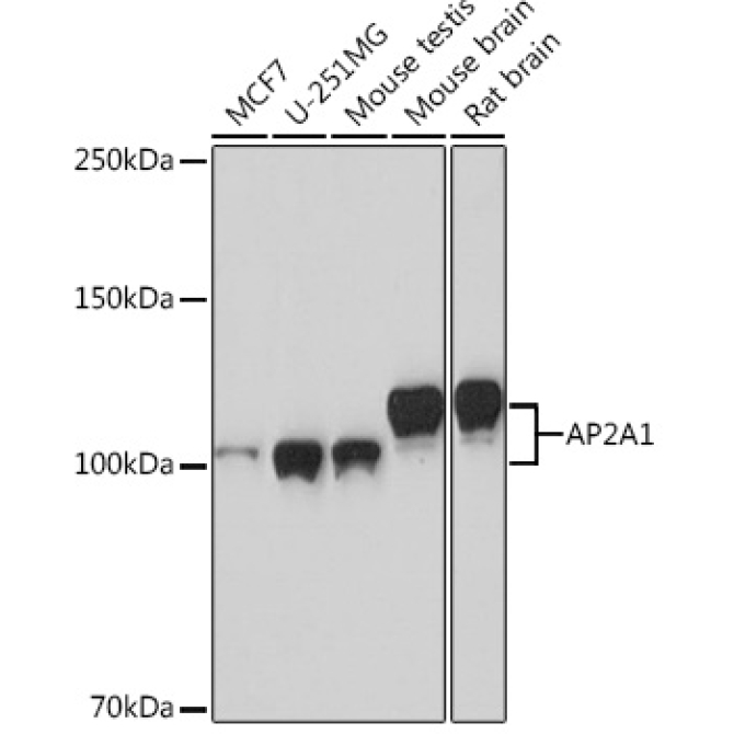 AP2A1 Rabbit Monoclonal Antibody