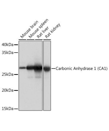Carbonic Anhydrase 1 (CA1) Rabbit Monoclonal Antibody