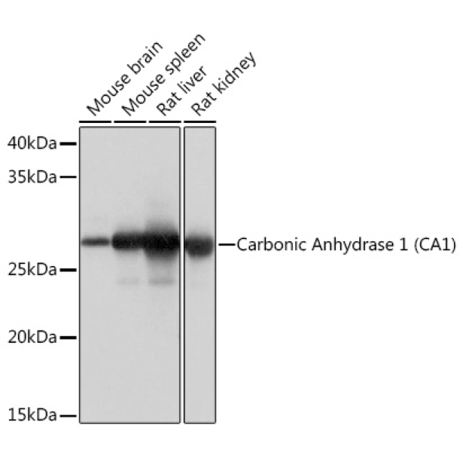 Carbonic Anhydrase 1 (CA1) Rabbit Monoclonal Antibody